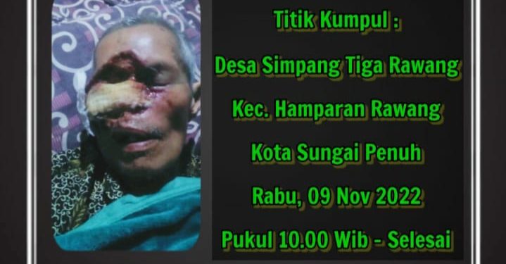 Idap Tumor di Wajah, Kakek Rusdi Dahlan Mohon Bantuan
