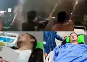 Jari Tangan Wabup Putus Terkena Ledakan Petasan Saat Malam Tahun Baru