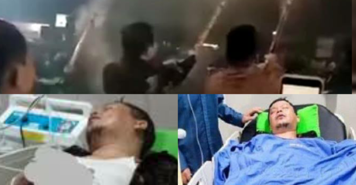 Jari Tangan Wabup Putus Terkena Ledakan Petasan Saat Malam Tahun Baru
