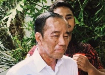 Bercak Putih di Wajah Jokowi Viral di Hari Ulang Tahun ke-64, Dokter Tifa: “Anda Sakit Serius”
