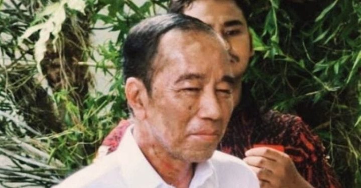 Bercak Putih di Wajah Jokowi Viral di Hari Ulang Tahun ke-64, Dokter Tifa: “Anda Sakit Serius”