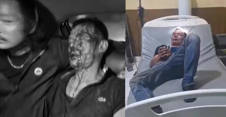 Pria 61 Tahun Dihajar Massa Usai Kepergok Mencuri di Sungai Penuh