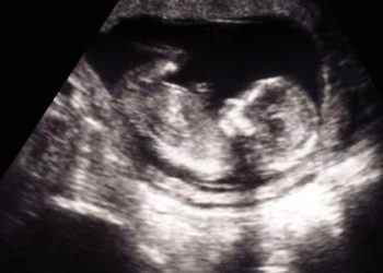 Tragis! Janin 9 Bulan Warga Jambi Meninggal Usai Disuntik Obat Alergi oleh Dokter Umum