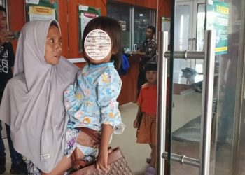 Heboh Siswi SD di Palembang Alami Mata Lebam, Dokter Ungkap Temuan Mengejutkan